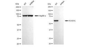 KD-Validated Anti ACADVL Antibody, clone 23GB3615, Rabbit Monoclonal clone 23GB3615, recombinant rabbit monoclonal, expressed in HEK293 cells