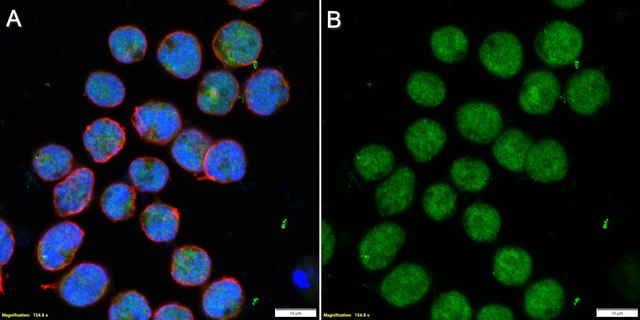 Anti-WRN Antibody, clone 20A11.1 ZooMAb&#174; Mouse Monoclonal recombinant, expressed in HEK 293 cells