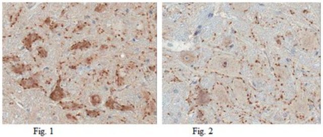 Anti-Vesicular Acetylcholine Transporter (VAChT) Antibody from goat, purified by affinity chromatography