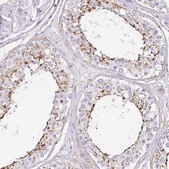 Anti-MTTP antibody produced in rabbit Prestige Antibodies® Powered by Atlas Antibodies, affinity isolated antibody, buffered aqueous glycerol solution