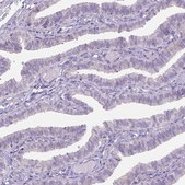 Anti-ADGRV1 antibody produced in rabbit Prestige Antibodies® Powered by Atlas Antibodies, affinity isolated antibody