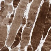 Anti-OAZ1 antibody produced in rabbit Prestige Antibodies® Powered by Atlas Antibodies, affinity isolated antibody, buffered aqueous glycerol solution