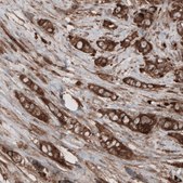 Monoclonal Anti-CARS antibody produced in mouse Prestige Antibodies® Powered by Atlas Antibodies, clone CL2304, purified immunoglobulin, buffered aqueous glycerol solution