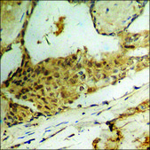 Anti-phospho-BCL-XL (pSer62) antibody produced in rabbit affinity isolated antibody