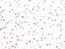 Anti-MAD2B/MAD2L2 antibody produced in rabbit