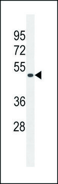 ANTI-TAPT1 (C-TERM) antibody produced in rabbit IgG fraction of antiserum, buffered aqueous solution