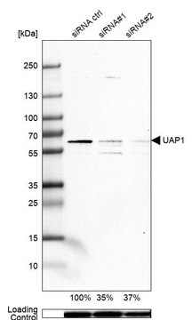 Anti-UAP1 antibody produced in rabbit Prestige Antibodies&#174; Powered by Atlas Antibodies, affinity isolated antibody, buffered aqueous glycerol solution