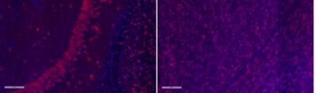 Anti-Tau Antibody, clone PC1C6, Alexa Fluor&#8482; 555 Conjugate clone PC1C6, from mouse, ALEXA FLUOR&#8482; 555