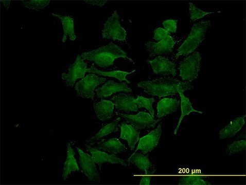 Monoclonal Anti-CDK4 antibody produced in mouse clone 4F11, purified immunoglobulin, buffered aqueous solution