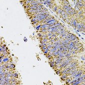 Anti-ALDH1A1 antibody produced in rabbit