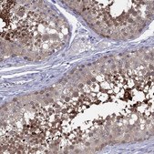 Anti-CYB5R2 Prestige Antibodies® Powered by Atlas Antibodies, affinity isolated antibody
