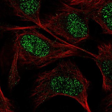 Anti-GUCY1A3 antibody produced in rabbit Prestige Antibodies&#174; Powered by Atlas Antibodies, affinity isolated antibody