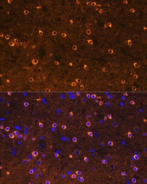 Anti-CRMP2/DPYSL2 antibody produced in rabbit