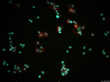 VOA1066 Human Undifferentiated Endometrial Carcinoma Cell Line