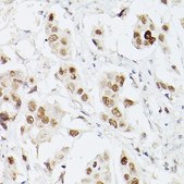 Anti-Pan Lactic acid-Lysine antibody produced in rabbit