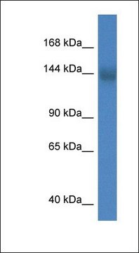 Anti-TMEM2 antibody produced in rabbit affinity isolated antibody