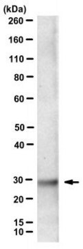 Anti-Mitochondrial ferritin/FTMT Antibody, clone C65-2