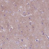 Anti-GABRB2 antibody produced in rabbit Prestige Antibodies® Powered by Atlas Antibodies, affinity isolated antibody, buffered aqueous glycerol solution