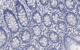 Anti-TGN46 Antibody, clone 2F13 ZooMAb® Rabbit Monoclonal recombinant, expressed in HEK 293 cells