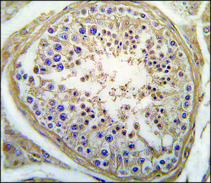 Anti-LHB (C-term) antibody produced in rabbit saturated ammonium sulfate (SAS) precipitated, buffered aqueous solution