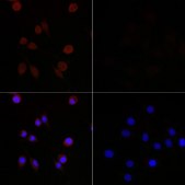 Anti-MAP1LC3B antibody produced in mouse