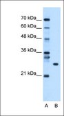 Anti-RBPMS antibody produced in rabbit affinity isolated antibody