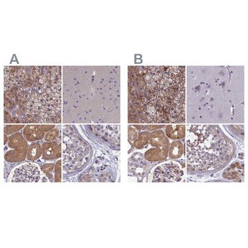 Anti-AMDHD2 antibody produced in rabbit Prestige Antibodies&#174; Powered by Atlas Antibodies, affinity isolated antibody, buffered aqueous glycerol solution