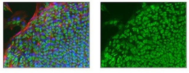 Anti-TRIM33 Antibody, clone 3B5.1 clone 3B5.1, 1&#160;mg/mL, from mouse