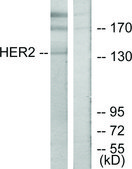 Anti-HER2 antibody produced in rabbit affinity isolated antibody