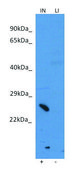 Anti-SLC25A35 antibody produced in rabbit affinity isolated antibody