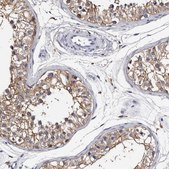 Anti-EPB41L3 antibody produced in rabbit Prestige Antibodies® Powered by Atlas Antibodies, affinity isolated antibody, buffered aqueous glycerol solution