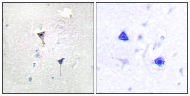 Anti-PKD1 antibody produced in rabbit affinity isolated antibody