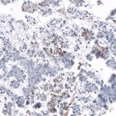 Anti-L1CAM antibody produced in mouse Prestige Antibodies® Powered by Atlas Antibodies, clone CL12988, purified by using Protein A, buffered aqueous glycerol solution