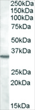 Anti-Bradykinin Receptor B1 antibody produced in goat affinity isolated antibody, buffered aqueous solution