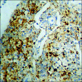 Anti-phospho-PKC-pan (pThr497) antibody produced in rabbit affinity isolated antibody