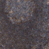 Anti-SAMD9L antibody produced in rabbit Prestige Antibodies® Powered by Atlas Antibodies, affinity isolated antibody, buffered aqueous glycerol solution, Ab3