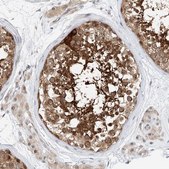 Anti-CLDND1 antibody produced in rabbit Prestige Antibodies® Powered by Atlas Antibodies, affinity isolated antibody, buffered aqueous glycerol solution, ab1