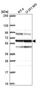 Anti-SARS antibody produced in rabbit Prestige Antibodies® Powered by Atlas Antibodies, affinity isolated antibody