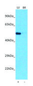 Anti-OTUD1 (C-terminal) antibody produced in rabbit affinity isolated antibody
