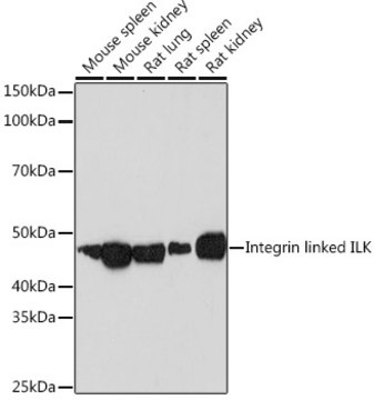 Anti-Integrin linked ILK Antibody, clone 5R10U3, Rabbit Monoclonal