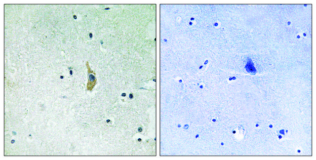 Anti-PSEN1 antibody produced in rabbit affinity isolated antibody