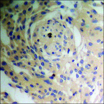 抗-磷酸化-Tuberin/TSC2 (pSer939) 兔抗 affinity isolated antibody