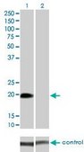 Monoclonal Anti-STK32A antibody produced in mouse clone 3E8-1D3, purified immunoglobulin, buffered aqueous solution
