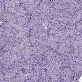 抗-AMOT 兔抗 Prestige Antibodies® Powered by Atlas Antibodies, affinity isolated antibody, buffered aqueous glycerol solution