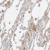 Anti-C8B antibody produced in rabbit Prestige Antibodies® Powered by Atlas Antibodies, affinity isolated antibody, buffered aqueous glycerol solution