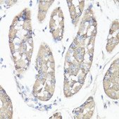 Anti-FAK antibody produced in rabbit