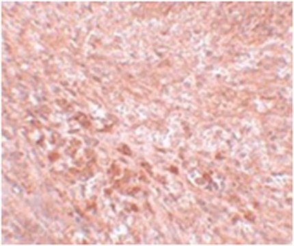 Anti-LZTR2 Antibody from rabbit, purified by affinity chromatography