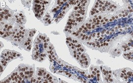 Anti-CHD-8 Antibody, clone 1H9 ZooMAb® Rabbit Monoclonal recombinant, expressed in HEK 293 cells