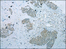 Anti-RPL35A affinity isolated antibody