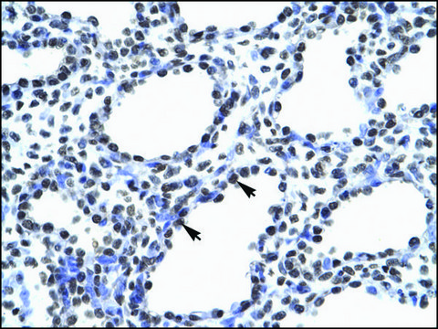 Anti-MyEF2 antibody produced in rabbit affinity isolated antibody